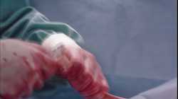 Dr- Romantic ดอกเตอร์ โรแมนติก ปี1 EP17